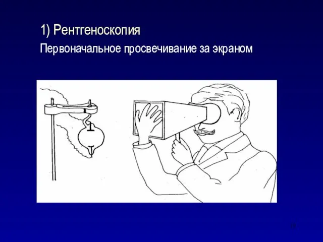 1) Рентгеноскопия Первоначальное просвечивание за экраном