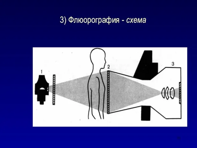 3) Флюорография - схема