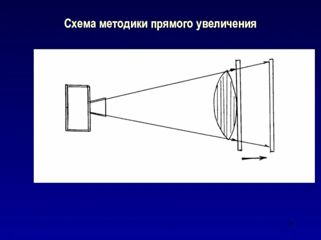 Схема методики прямого увеличения