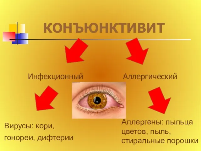 КОНЪЮНКТИВИТ Инфекционный Аллергический Вирусы: кори, гонореи, дифтерии Аллергены: пыльца цветов, пыль, стиральные порошки