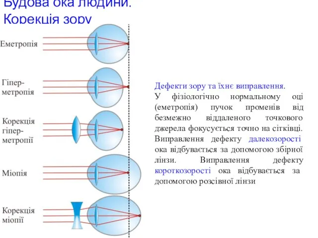 Будова ока людини. Корекція зору Дефекти зору та їхнє виправлення. У фізіологічно