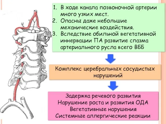 В ходе канала позвоночной артерии много узких мест. Опасны даже небольшие механические