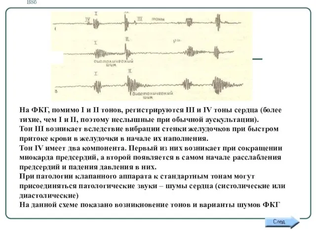 В8б На ФКГ, помимо I и II тонов, регистрируются III и IV