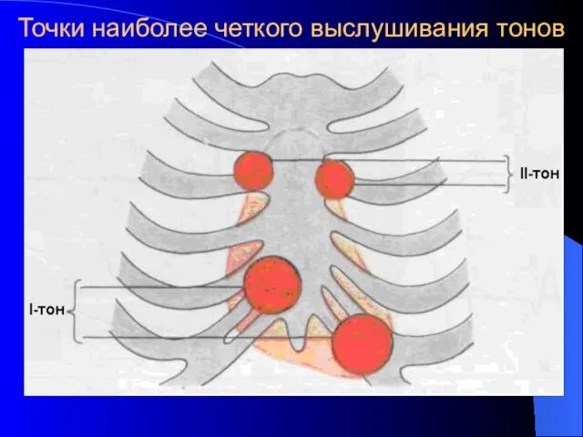 Точки наиболее четкого выслушивания тонов