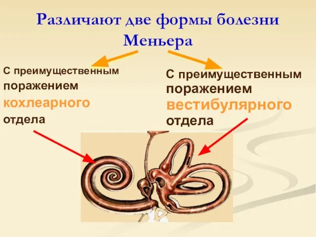 Различают две формы болезни Меньера С преимущественным поражением кохлеарного отдела С преимущественным поражением вестибулярного отдела