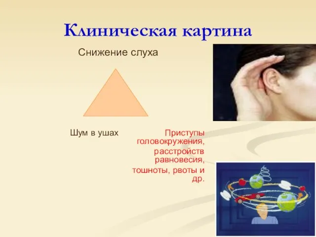 Клиническая картина Снижение слуха Шум в ушах Приступы головокружения, расстройств равновесия, тошноты, рвоты и др.