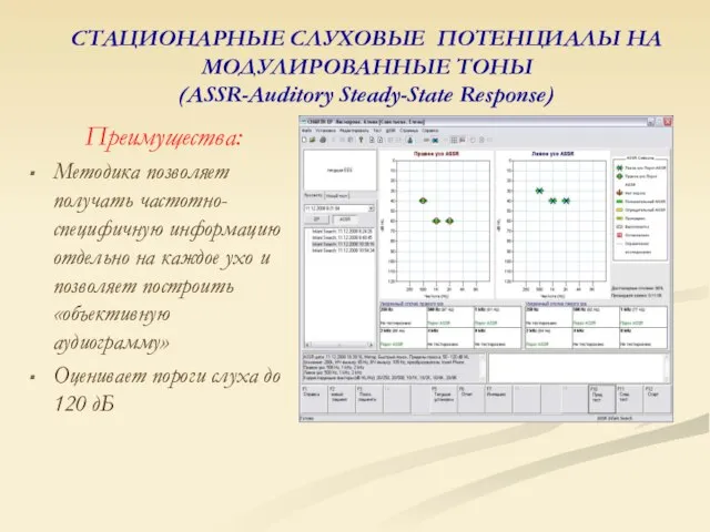 СТАЦИОНАРНЫЕ СЛУХОВЫЕ ПОТЕНЦИАЛЫ НА МОДУЛИРОВАННЫЕ ТОНЫ (ASSR-Auditory Steady-State Response) Преимущества: Методика позволяет