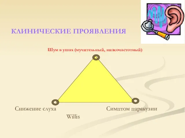 КЛИНИЧЕСКИЕ ПРОЯВЛЕНИЯ Шум в ушах (мучительный, низкочастотный) Снижение слуха Симптом паракузии Willis