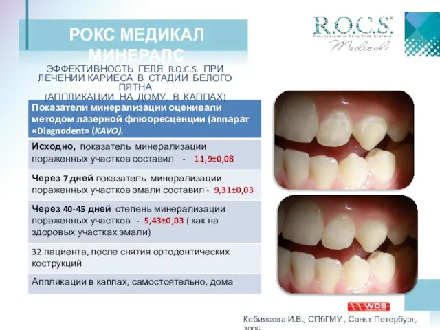 РОКС МЕДИКАЛ МИНЕРАЛС Кобиясова И.В., СПбГМУ , Санкт-Петербург, 2006 ЭФФЕКТИВНОСТЬ ГЕЛЯ R.O.C.S.