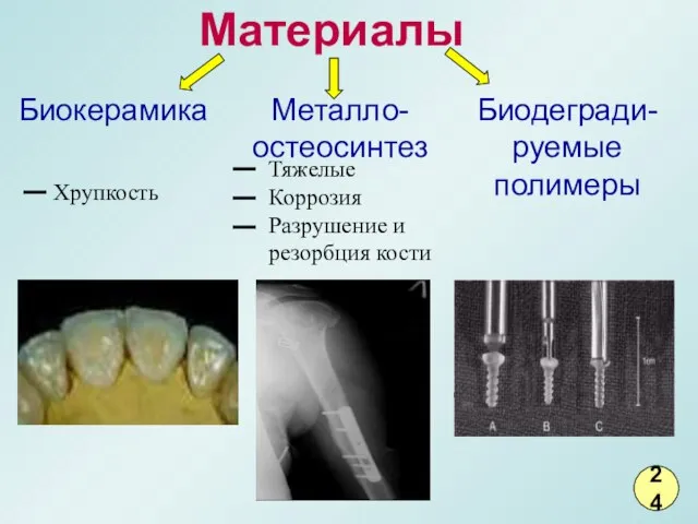 Материалы Тяжелые Коррозия Разрушение и резорбция кости Хрупкость 24