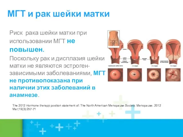 Риск рака шейки матки при использовании МГТ не повышен. Поскольку рак и