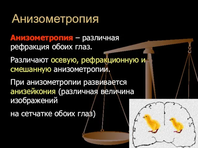 Анизометропия Анизометропия – различная рефракция обоих глаз. Различают осевую, рефракционную и смешанную