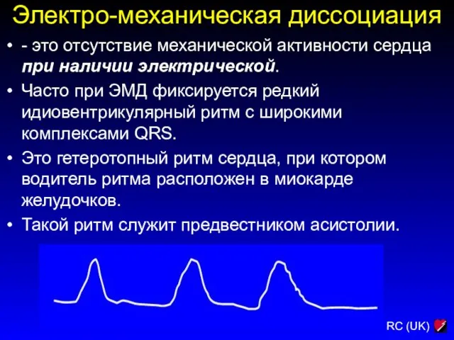 Электро-механическая диссоциация - это отсутствие механической активности сердца при наличии электрической. Часто