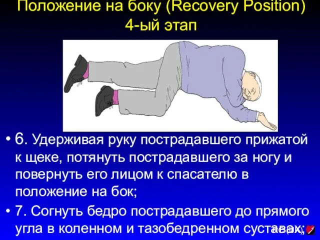 Положение на боку (Recovery Position) 4-ый этап 6. Удерживая руку пострадавшего прижатой