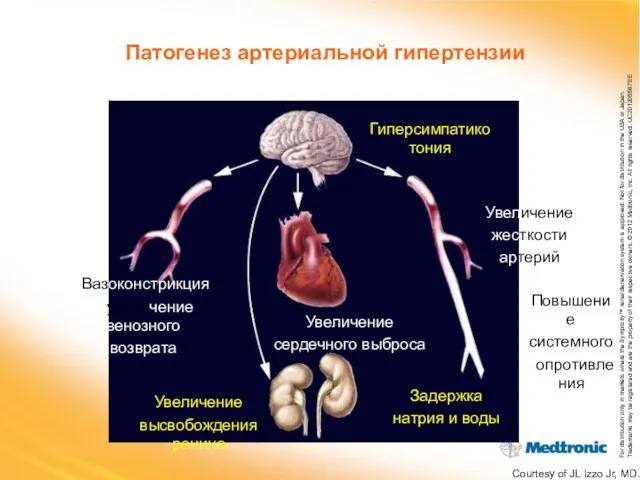 Патогенез артериальной гипертензии Гиперсимпатикотония Увеличение жесткости артерий Увеличение сердечного выброса Вазоконстрикция и