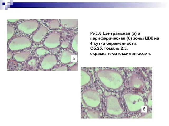 Рис.6 Центральная (а) и периферическая (б) зоны ЩЖ на 4 сутки беременности.