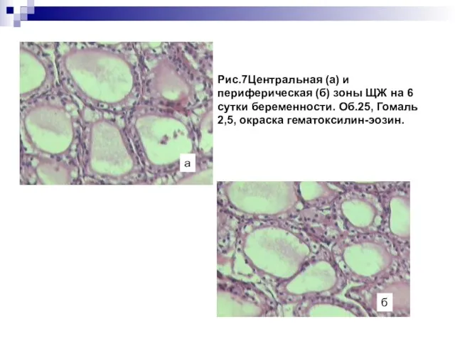 Рис.7Центральная (а) и периферическая (б) зоны ЩЖ на 6 сутки беременности. Об.25,