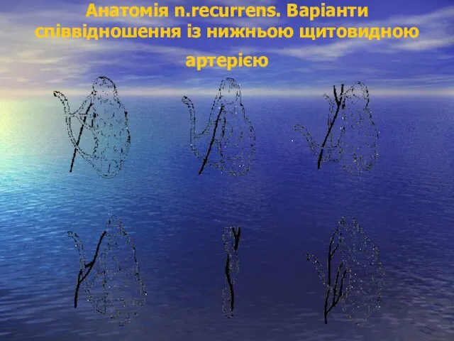 Анатомія n.recurrens. Варіанти співвідношення із нижньою щитовидною артерією