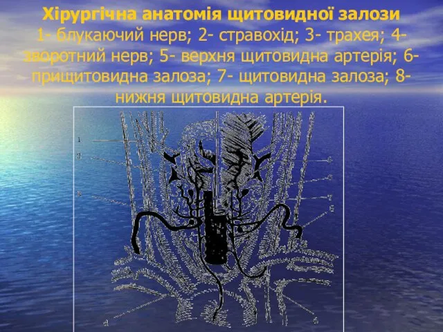 Хірургічна анатомія щитовидної залози 1- блукаючий нерв; 2- стравохід; 3- трахея; 4-