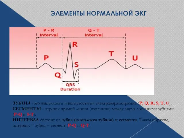 ЭЛЕМЕНТЫ НОРМАЛЬНОЙ ЭКГ ЗУБЦЫ - это выпуклости и вогнутости на электрокардиограмме (P;