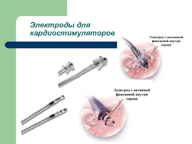 Электроды для кардиостимуляторов