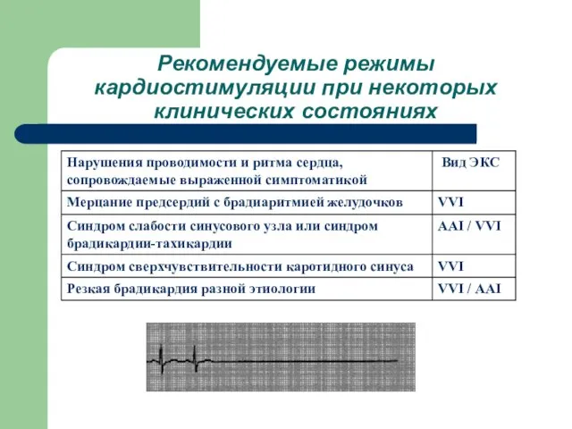 Рекомендуемые режимы кардиостимуляции при некоторых клинических состояниях