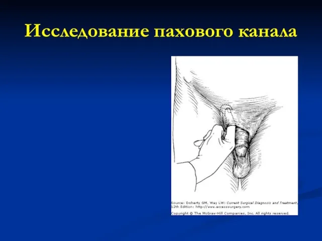 Исследование пахового канала