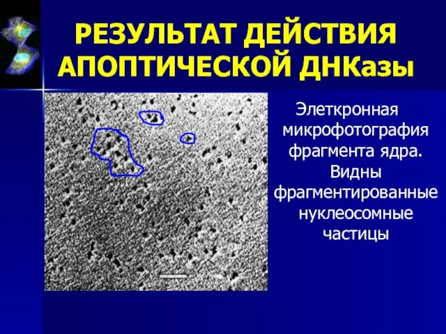 РЕЗУЛЬТАТ ДЕЙСТВИЯ АПОПТИЧЕСКОЙ ДНКазы Элеткронная микрофотография фрагмента ядра. Видны фрагментированные нуклеосомные частицы