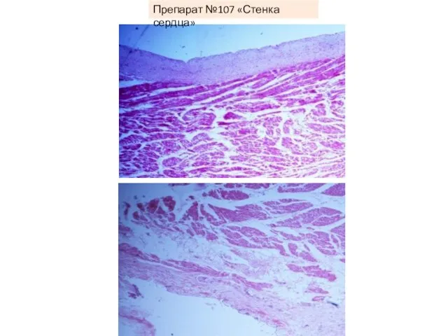 Препарат №107 «Стенка сердца»