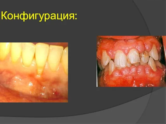 Конфигурация: