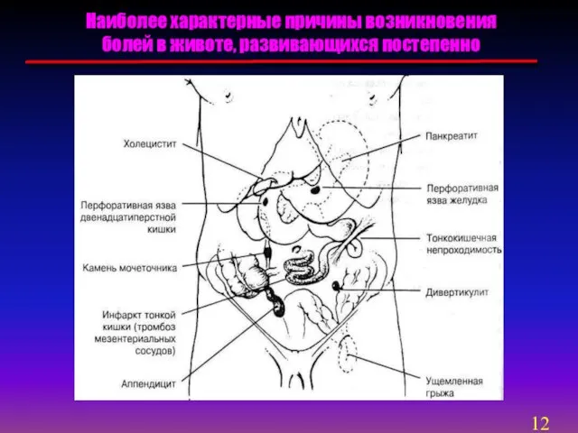 Наиболее характерные причины возникновения болей в животе, развивающихся постепенно