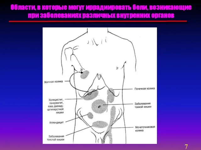 Области, в которые могут иррадиировать боли, возникающие при заболеваниях различных внутренних органов