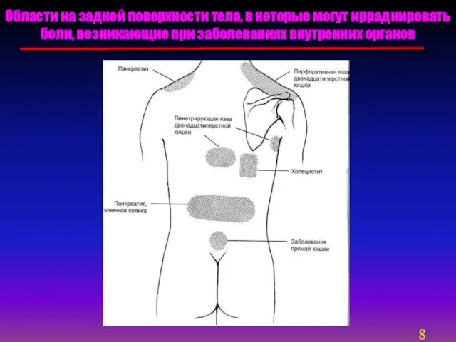 Области на задней поверхности тела, в которые могут иррадиировать боли, возникающие при заболеваниях внутренних органов