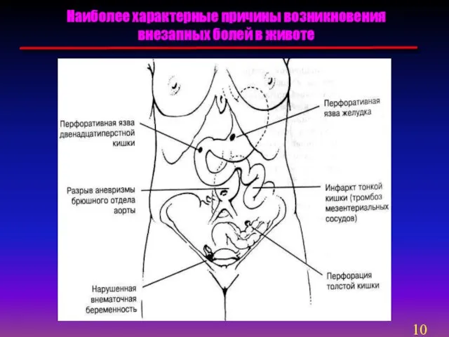 Наиболее характерные причины возникновения внезапных болей в животе