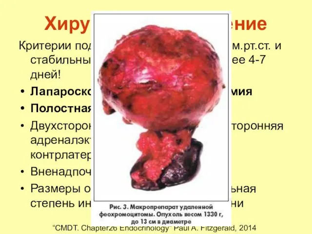 Хирургическое лечение Критерии подготовленности: 140/90 мм.рт.ст. и стабильные показатели ЭКГ не менее