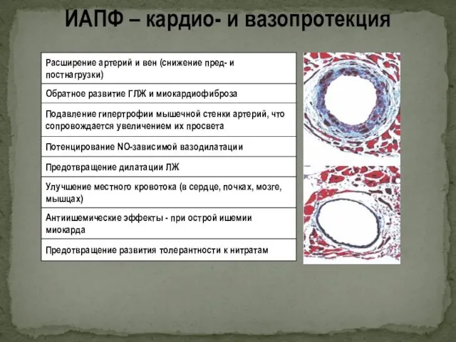 ИАПФ – кардио- и вазопротекция