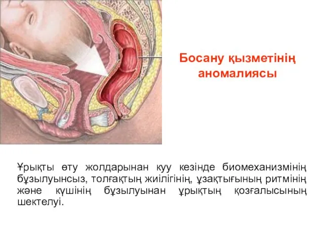 Босану қызметінің аномалиясы Ұрықты өту жолдарынан куу кезінде биомеханизмінің бұзылуынсыз, толғақтың жиілігінің,