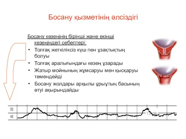 Босану қызметінің әлсіздігі Босану кезеңінің бірінші және екінші кезеңіндегі себептері: Толғақ жеткіліксіз