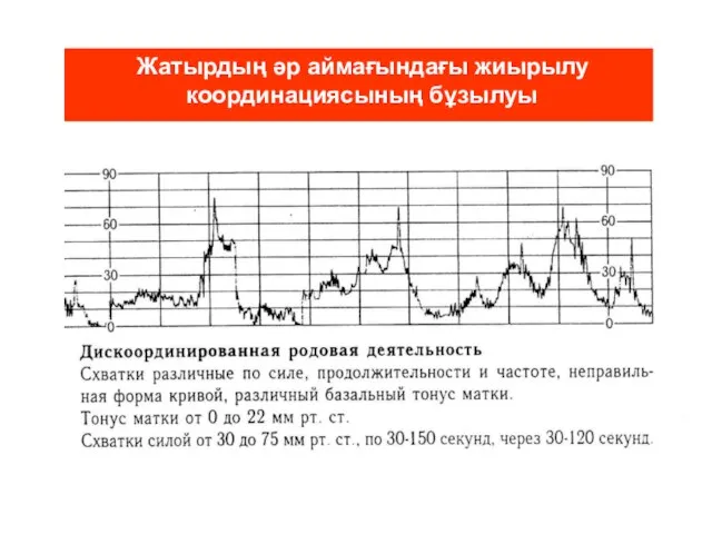 Жатырдың әр аймағындағы жиырылу координациясының бұзылуы