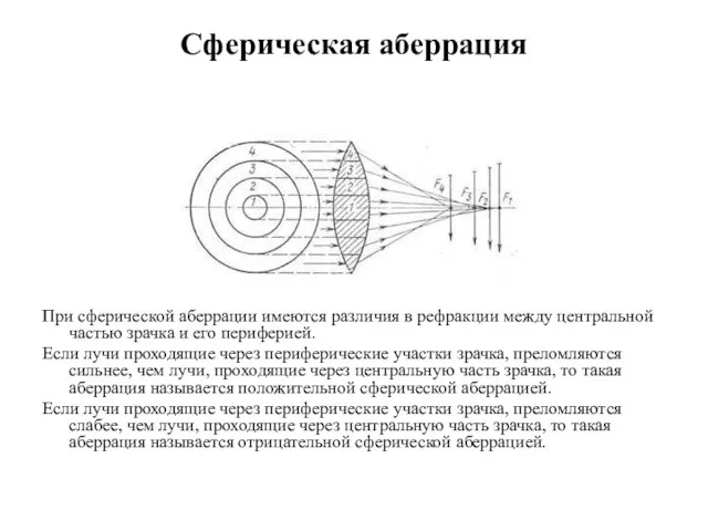 Сферическая аберрация При сферической аберрации имеются различия в рефракции между центральной частью