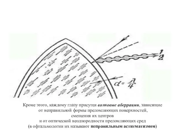 Кроме этого, каждому глазу присущи волновые аберрации, зависящие от неправильной формы преломляющих