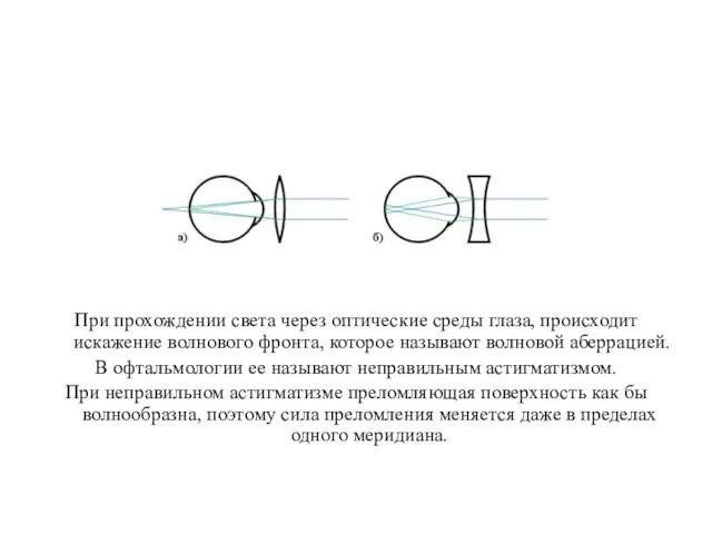 При прохождении света через оптические среды глаза, происходит искажение волнового фронта, которое