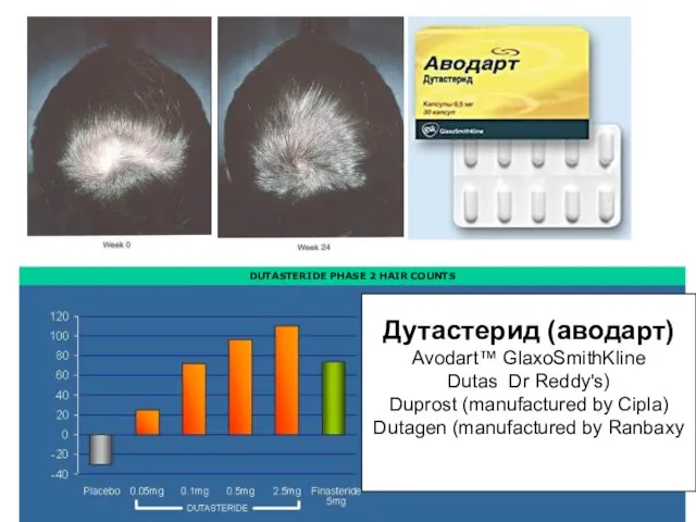 Дутастерид (аводарт) Avodart™ GlaxoSmithKline Dutas Dr Reddy's) Duprost (manufactured by Cipla) Dutagen (manufactured by Ranbaxy