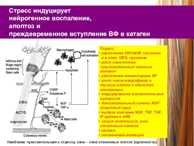 Стресс индуцирует нейрогенное воспаление, апоптоз и преждевременное вступление ВФ в катаген Стресс: