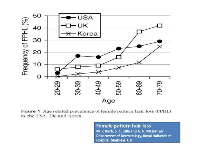 Female pattern hair loss M. P. Birch, S. C. Lalla and A.