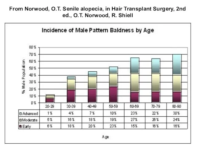 From Norwood, O.T. Senile alopecia, in Hair Transplant Surgery, 2nd ed., O.T. Norwood, R. Shiell