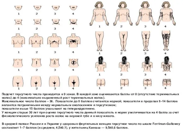 Подсчет гирсутного числа проводится в 9 зонах. В каждой зоне оцениваются баллы