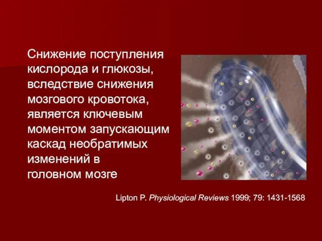 Снижение поступления кислорода и глюкозы, вследствие снижения мозгового кровотока, является ключевым моментом