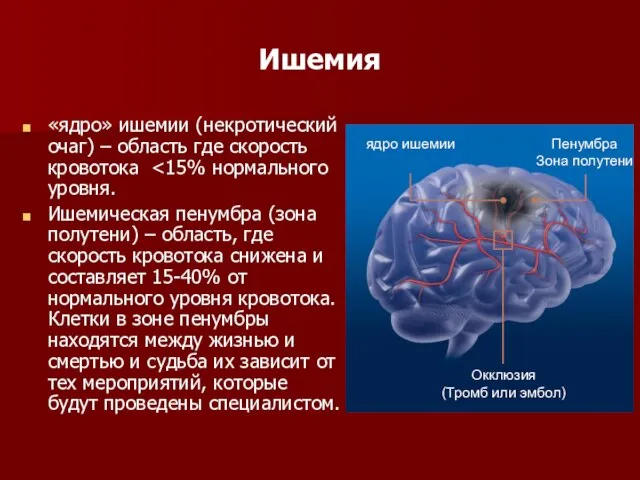 Ишемия «ядро» ишемии (некротический очаг) – область где скорость кровотока Ишемическая пенумбра