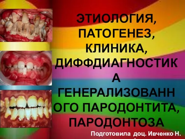 ЭТИОЛОГИЯ, ПАТОГЕНЕЗ, КЛИНИКА, ДИФФДИАГНОСТИКА ГЕНЕРАЛИЗОВАННОГО ПАРОДОНТИТА, ПАРОДОНТОЗА Подготовила доц. Ивченко Н.А.